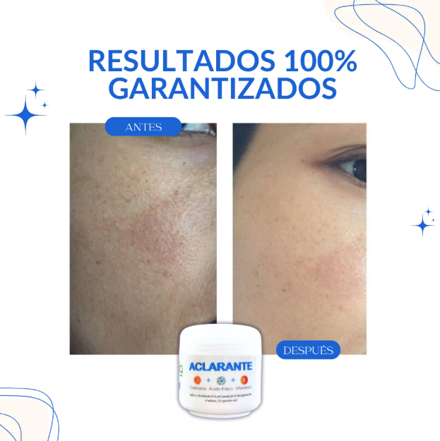 Crema Aclarante Zamia
