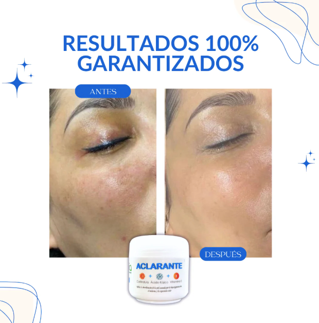 Crema Aclarante Zamia